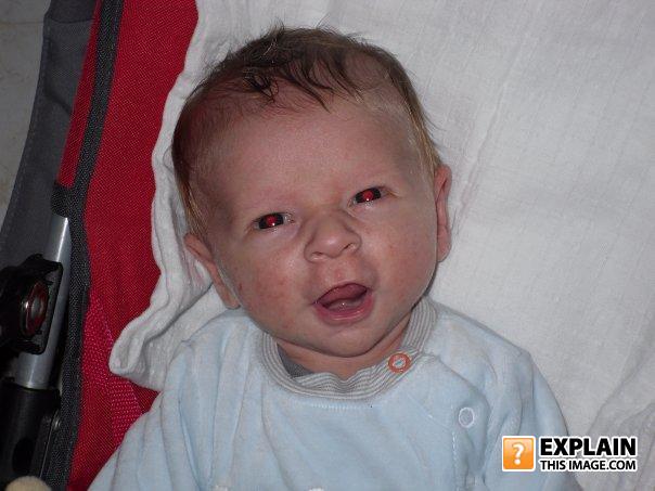 Ugly_baby