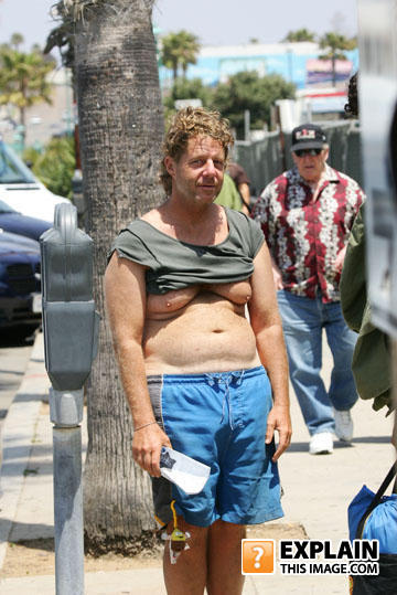 Man_boobs