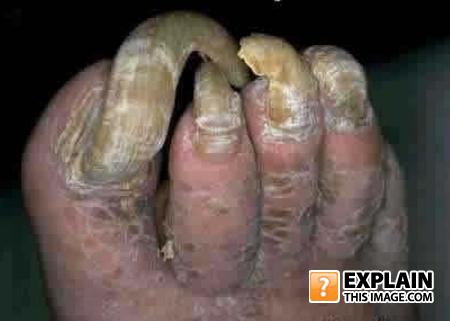 Footjpg98989